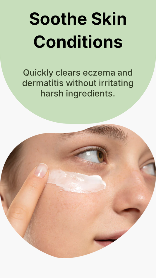 Eczema Recuperating Cream