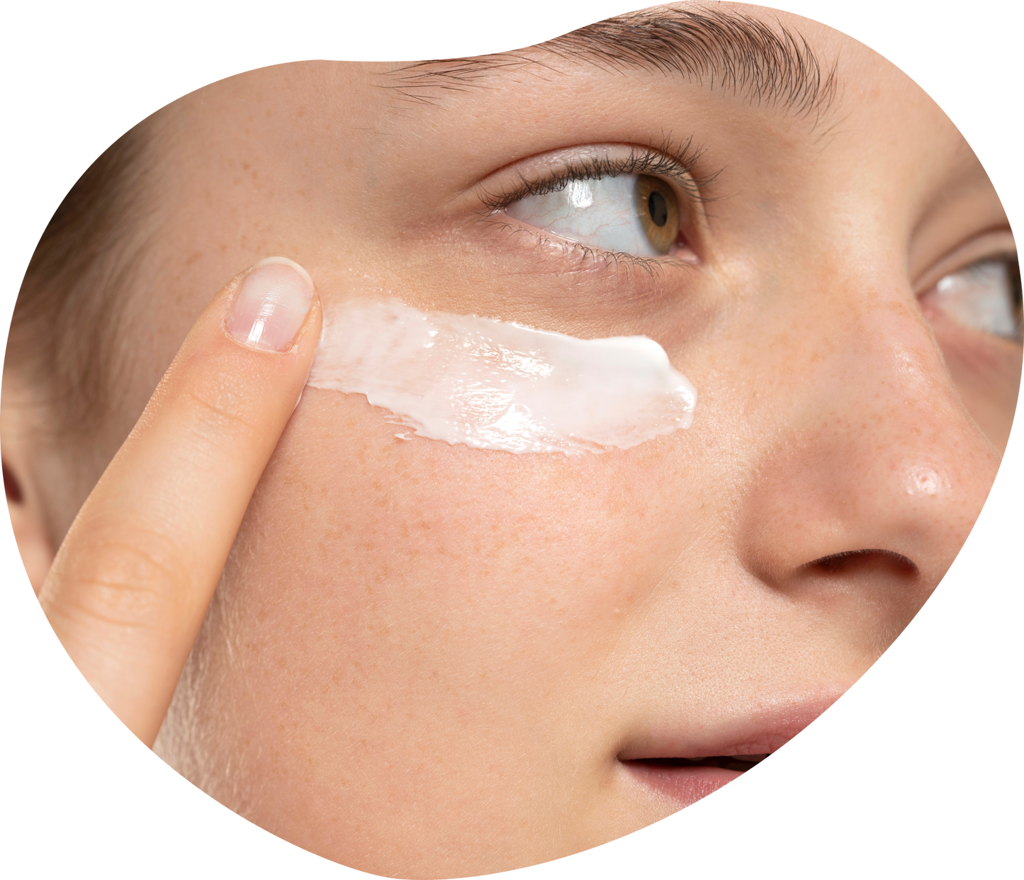 Eczema Recuperating Cream  5x tubes