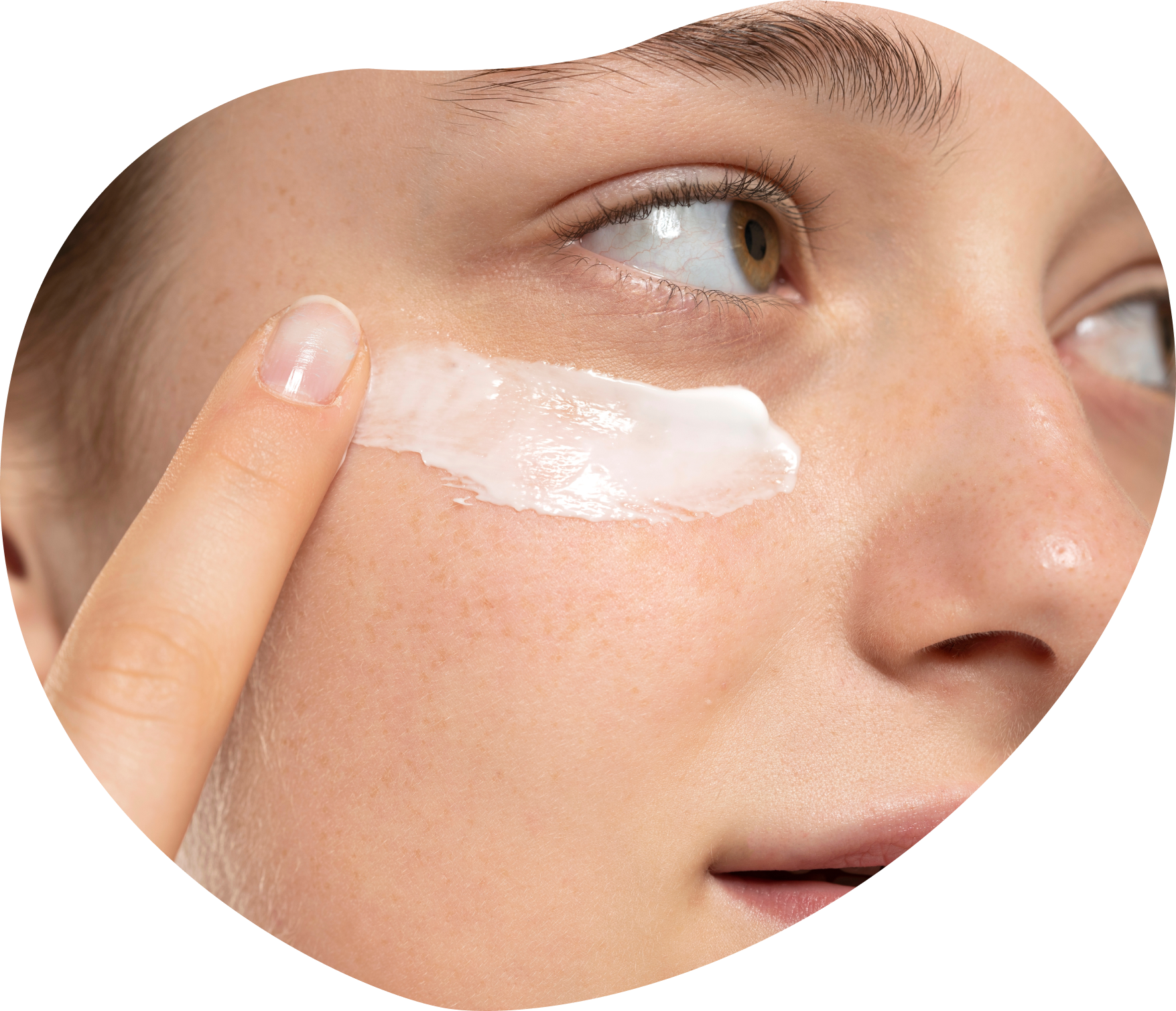 Eczema Recuperating Cream  2x tubes